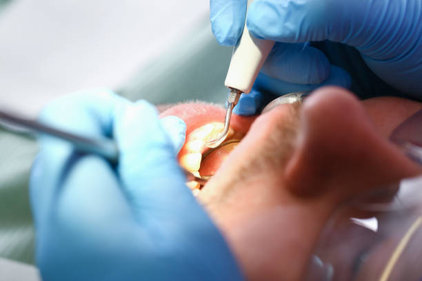 Best Broken or Cracked Tooth Emergency Dentist in Marcus, IA