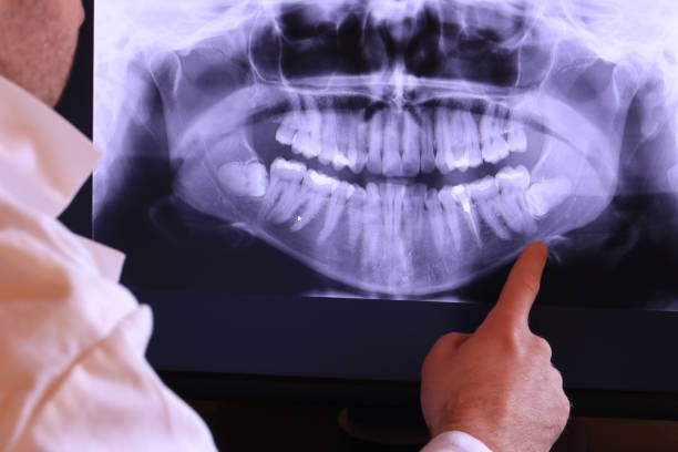 Best Emergency Dental Extractions in Marcus, IA