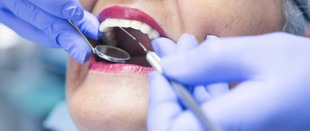Best Emergency Dentist for Knocked-Out Tooth in Marcus, IA